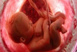 وصفات طبيعية لعلاج الغثيان الصباحي أثناء فترة الحمل