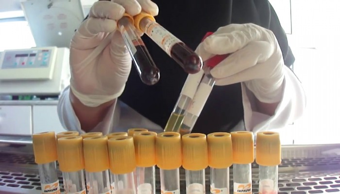 علماء بقطر ينجحون في تصنيع الدم بالمختبر