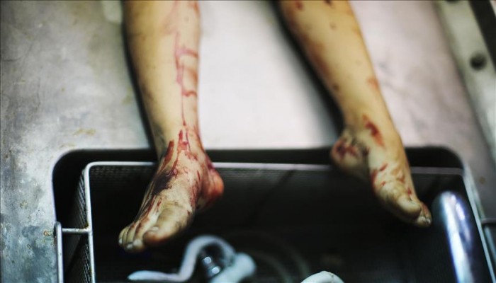 مسؤولة أممية: 38 طفلاً قتلوا في اليمن خلال أقل من شهرين