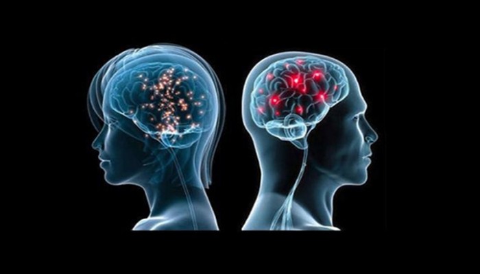 تعرف على الفرق الرئيسي بين دماغي المرأة والرجل