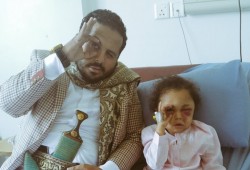 عين الإنسانية.. تضامن يمني مع الطفلة الناجية من قصف سعودي