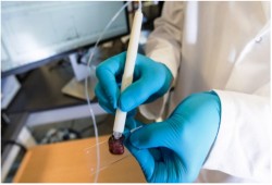 العلماء يخترعون قلم يحدد الأنسجة المصابة بالسرطان في 10 ثواني