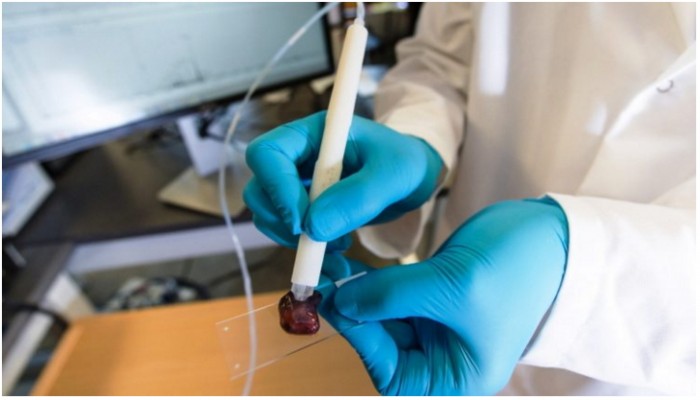 العلماء يخترعون قلم يحدد الأنسجة المصابة بالسرطان في 10 ثواني