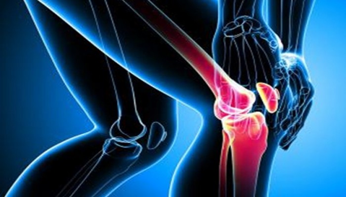 مصاب بإلتهاب مفصل الركبة؟ هذا هي الحل!