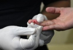 مضاد فيروسي ثلاثي يقدم نتائج واعدة لمعالجة الإيدز