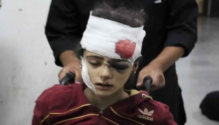 أكثر من 90 غارة خلفت 17 شهيداً في ريف إدلب اليوم