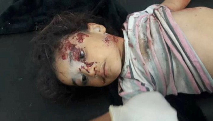 مجزرة في بلدة حوير العيس جنوب حلب جراء غارات جوية روسية