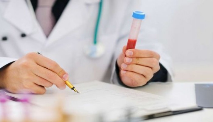 اختبار دم سريع يتنبأ بالنوبات القلبية