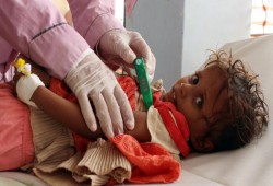 حالات الكوليرا باليمن قد تصل المليون نهاية العام