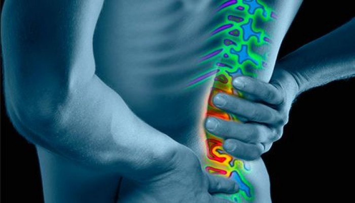 3 أسباب لآلام الظهر