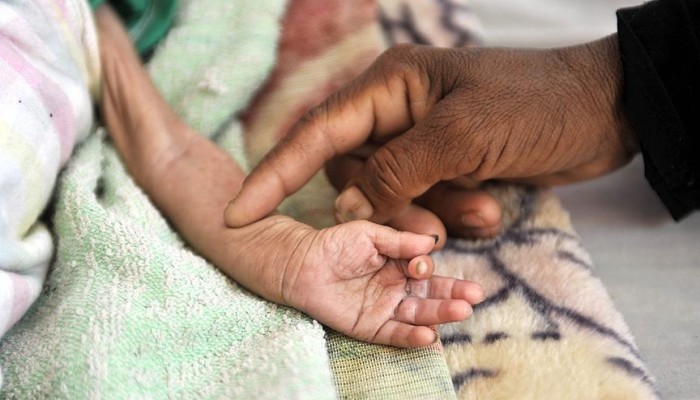 الشبكة السورية: 397 مدنيا قضوا جوعا بسبب حصار النظام لغوطة دمشق