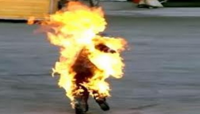 شاب يحرق صديقه بالبنزين بسبب المزاح في البحيرة