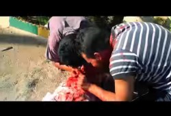 بعد حادثة العض .. ما هو مخدر "الفلاكا" الذي يحول متعاطية لـ"زومبي"