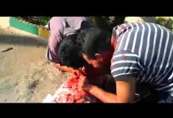 بعد حادثة العض .. ما هو مخدر "الفلاكا" الذي يحول متعاطية لـ"زومبي"