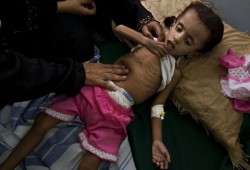 التحالف العربي يمنع المساعدات الأممية من الوصول لليمن