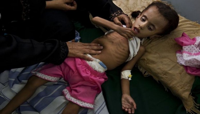 التحالف العربي يمنع المساعدات الأممية من الوصول لليمن