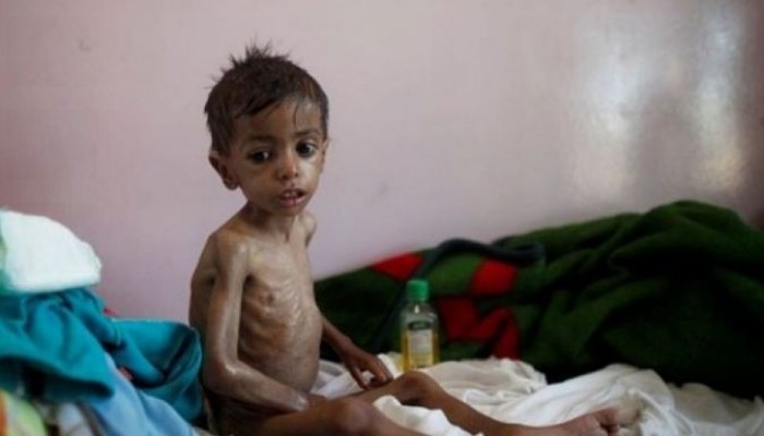 الصحة العالمية: وفيات الكوليرا في اليمن تتجاوز 2200 حالة