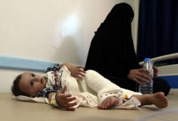 الأمم المتحدة: أكثر من 3 ملايين يمني مهددون بالجوع