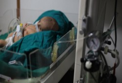 "يونيسف": وفاة 5 أطفال بغوطة دمشق الشرقية نتيجة الحصار