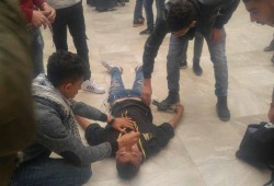 إصابات في مواجهات مع الاحتلال بالضفة والقدس