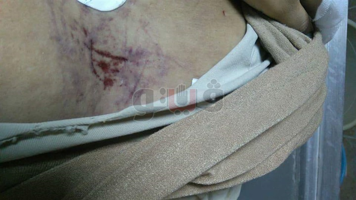 التقرير الطبي يكشف وجود كسر ونزيف وكدمات بجثمان معلمة الإسكندرية (صور)