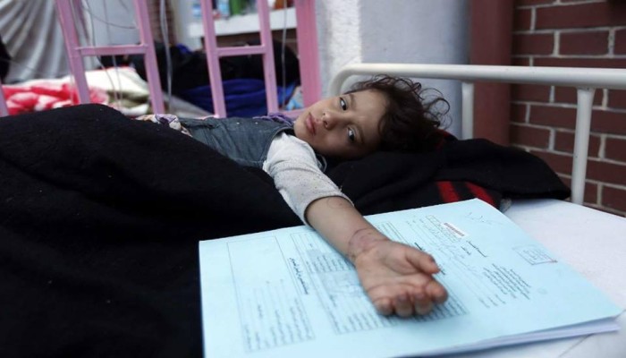 ارتفاع وفيات الدفتيريا في اليمن إلى 53 حالة