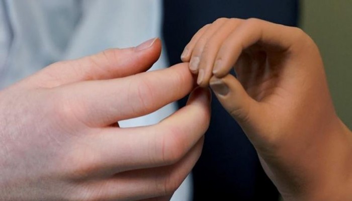 جلد إلكتروني يشعر بالحرارة والضغط