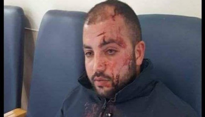 مستوطنون يعتدون على سائق حافلة من القدس