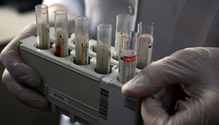 العراق.. 241 حالة إصابة مُسجلة بالإيدز ومخاوف من تفشي المرض