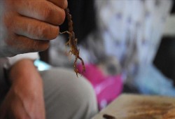 "عقرب" في طبق فول.. على مائدة طالبة بالمدينة الجامعية بأسيوط