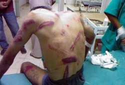 شهادات مؤلمة عن سجون الانقلاب في وثائقي على "BBC"