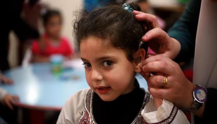 إيقاف إنزيم "CDK2" يحمي من فقدان السمع (دراسة)