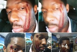 امرأة تعتدي على رجل أسود: "أنا بيضاء قد أقتلك ولن يحدث شيء"