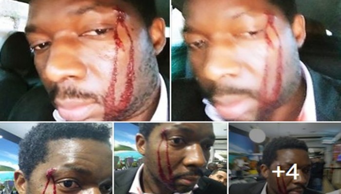 امرأة تعتدي على رجل أسود: "أنا بيضاء قد أقتلك ولن يحدث شيء"