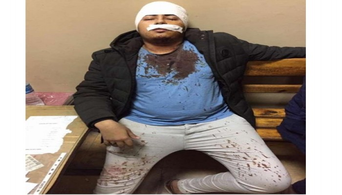 إسلام حاتم ضحية جديدة لـ«أوليكس»