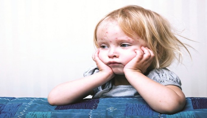 هكذا تحمي طفلك المصاب بالحساسية