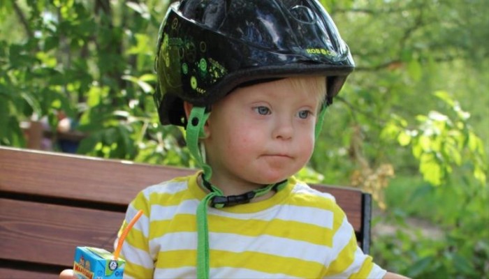 21 مارس اليوم العالمي لمتلازمة داون