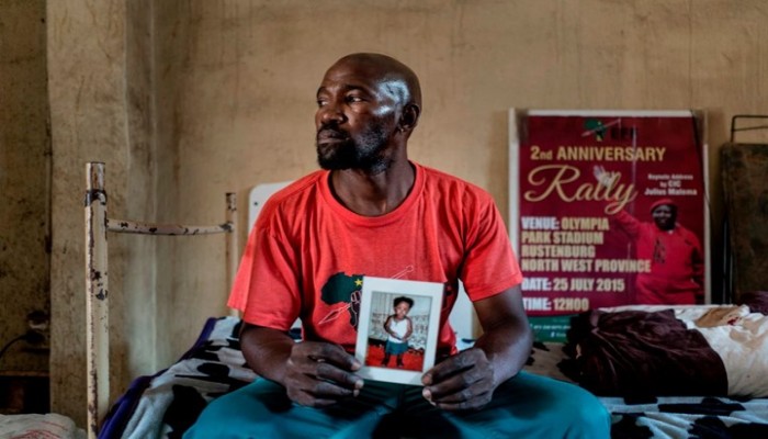 اليوم العالمي للسل.. 10 حقائق مهمة عن المرض