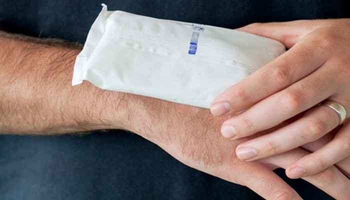 5 طرق شائعة معالجة الحروق.. تجنبها!