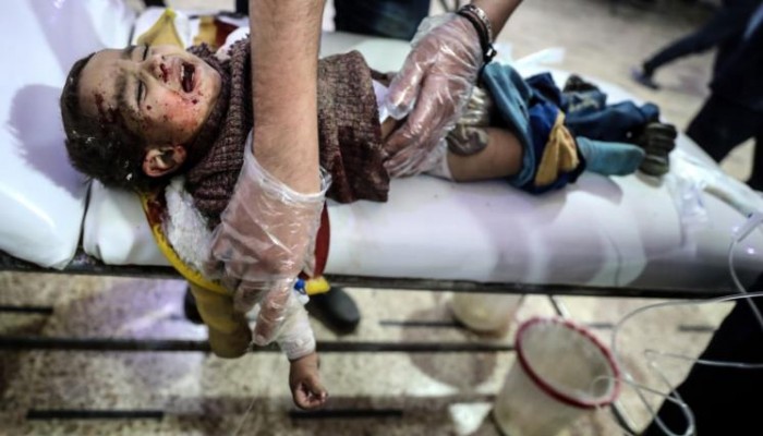 طالب طب يروي شهادات مؤثرة عن مآسي الغوطة