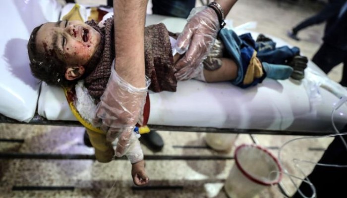 طالب طب يروي شهادات مؤثرة عن مآسي الغوطة