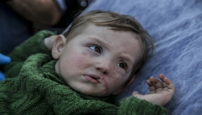 بتعليمات من أردوغان.. تركيا تعالج الرضيع السوري قاسم قهوجي