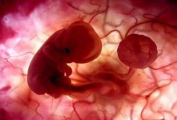 التحفيز العالي بالتلقيح الصناعي يعرض الأطفال لخطر أمراض القلب