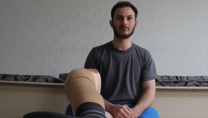 جمعية تركية تعيد البسمة لسوري فقد ساقه بقصف للنظام