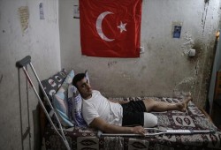 غزة.. حالات بتر أطراف جرحى مسيرة "العودة" ترتفع لـ21