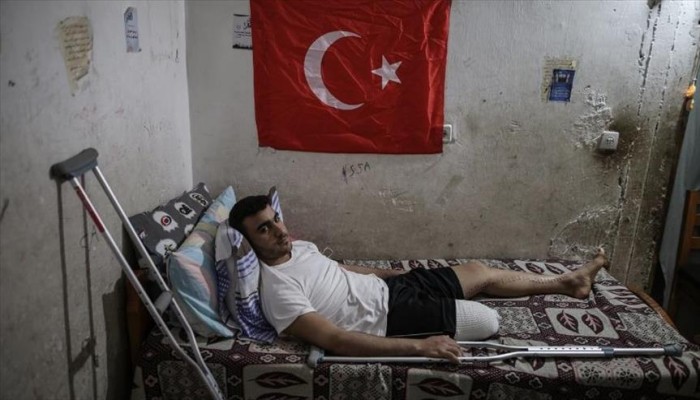 حالات بتر أطراف جرحى مسيرة "العودة" ترتفع لـ21