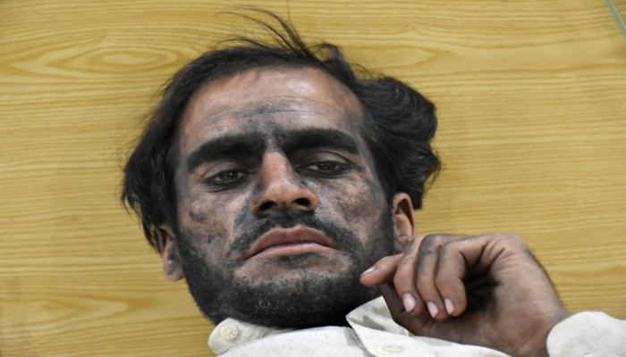 وفاة 23 شخصاً بانهيار منجمين في باكستان