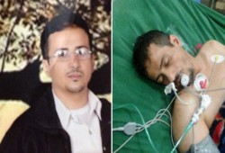 وفاة أحد إخوان اليمن بعد اختطافه وتعذيبه على يد الحوثيين