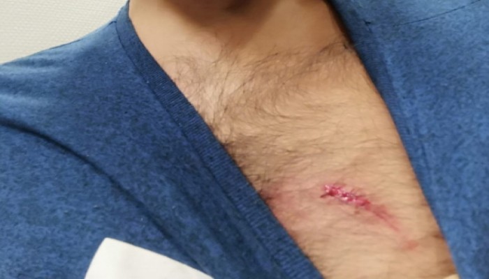 الشرطة الألمانية تفلت كلبا على شاب تركي