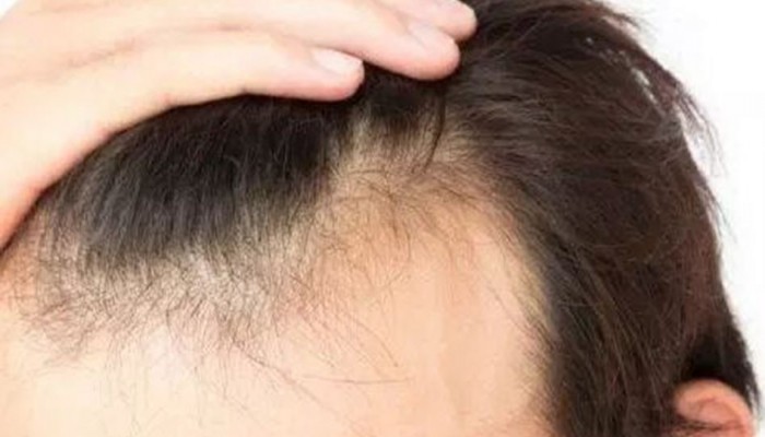 4 نصائح لزيادة نمو الشعر